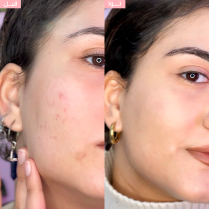 Le Pack "Everyday Glow"