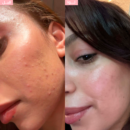 Le Pack "Everyday Glow"